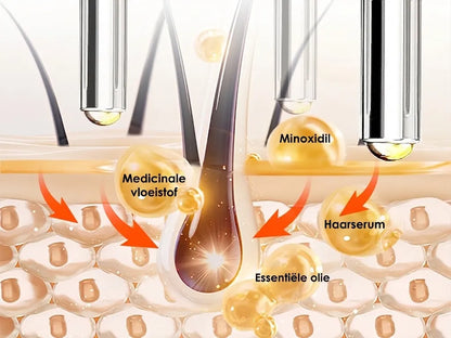 Minoxidil Applicator, Haarolie Applicator, Hoofdhuid Serum Kam, Breng de Vloeistof Direct op de Hoofdhuid Aan, Ondersteunend Haargroei Hulpmiddel, Voedt de Wortels Diepgaand